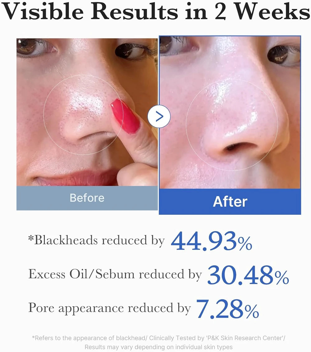 Medicube Zero Pore Pads